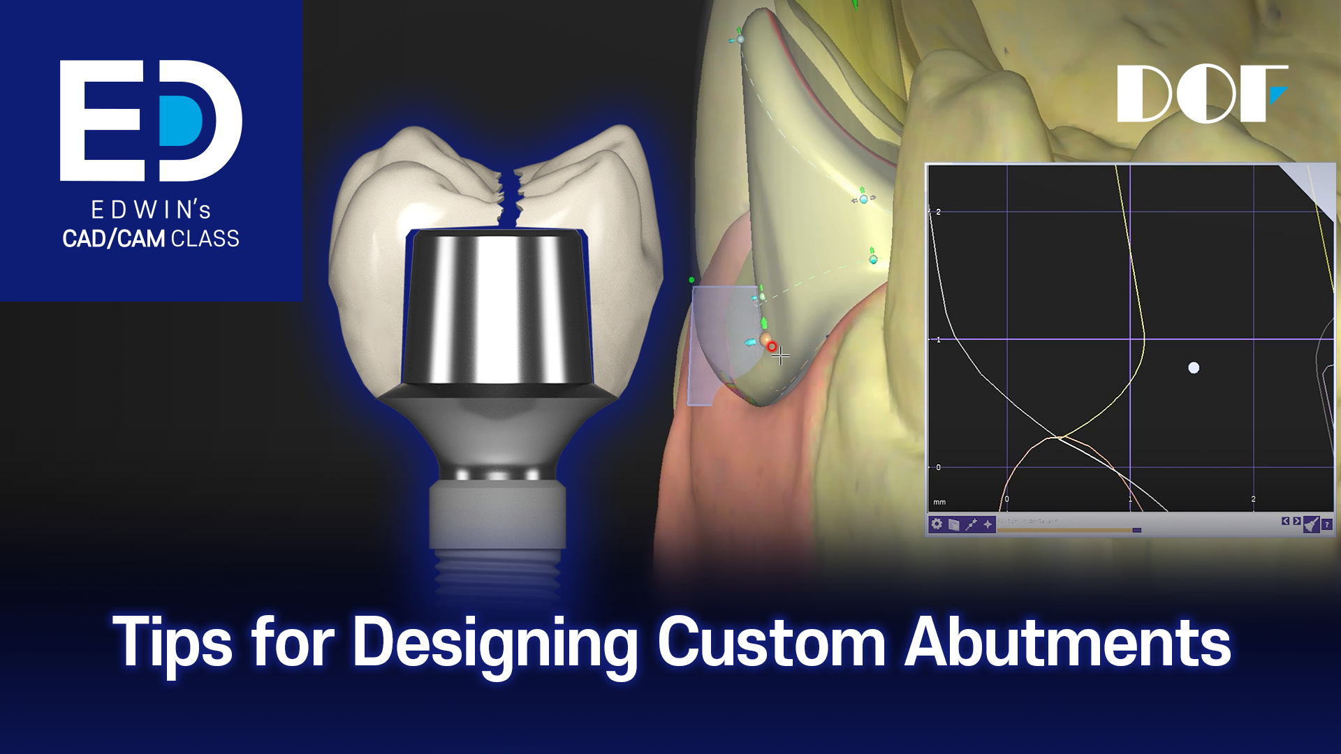 #8 Tips for Designing Custom Abutments_1.png
