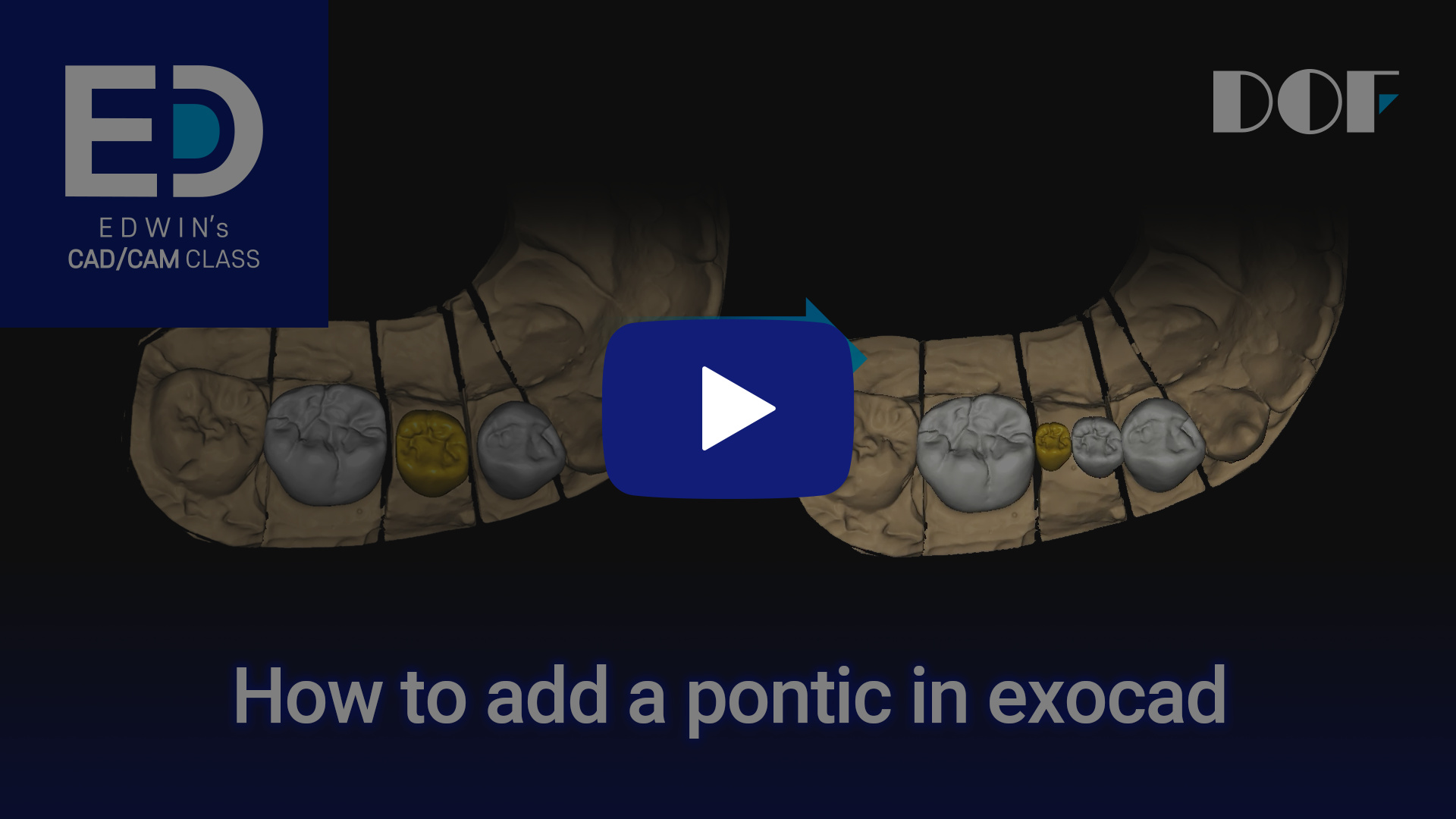 #20 How to Add a Pontic in exocad_4.jpg