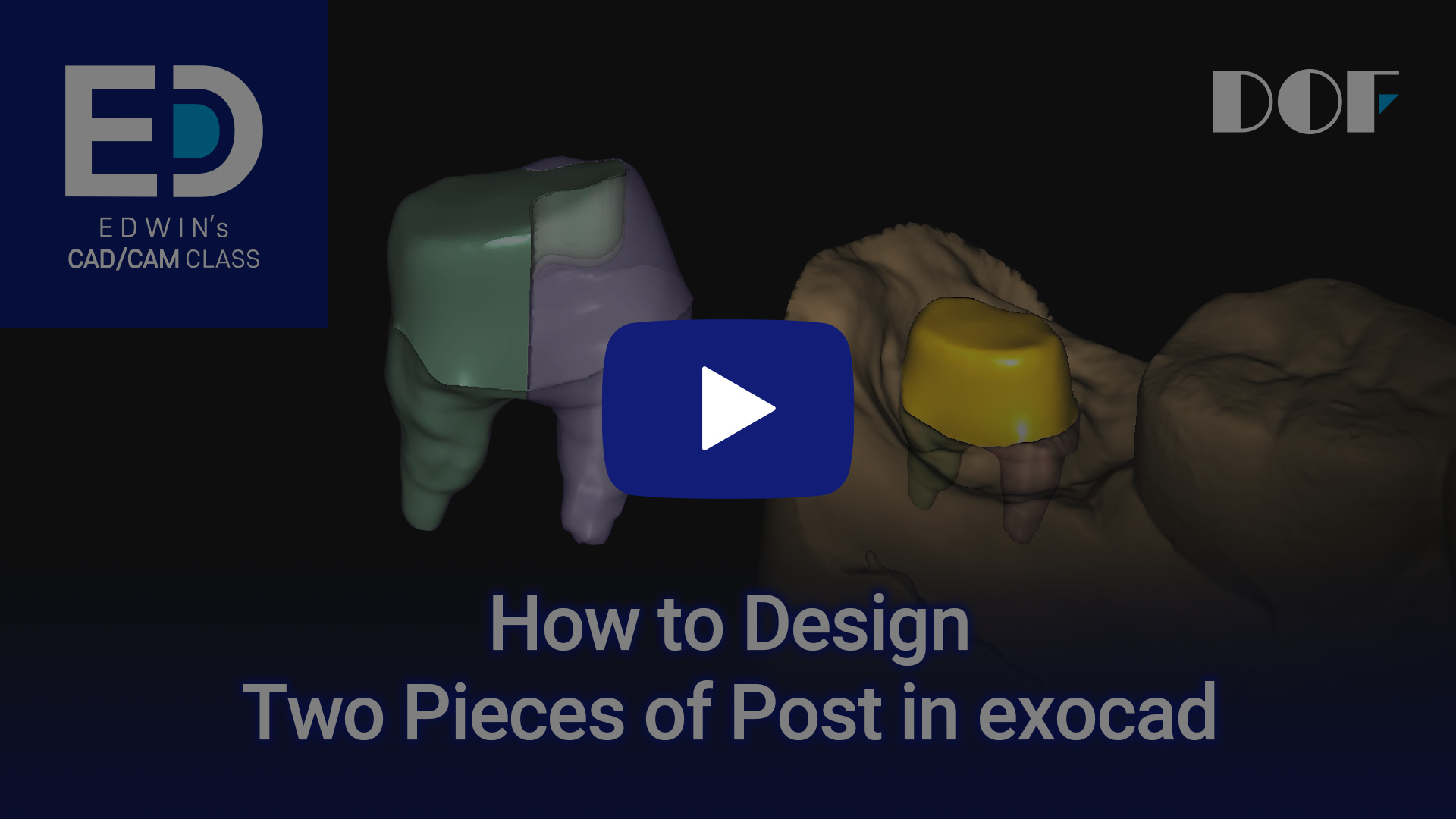 #22 How to Design Two Pieces of Post in exocad_4.jpg