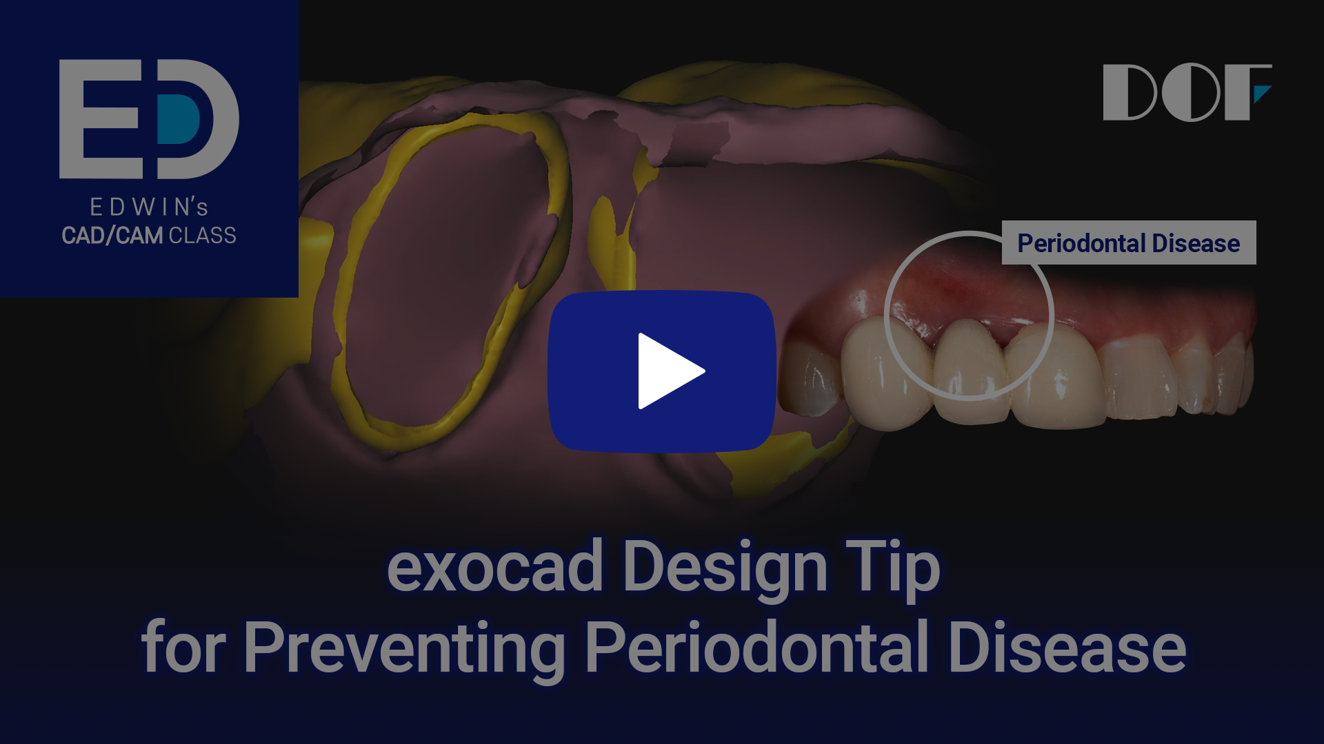 #12 How to Prevent Periodontal Disease_4.jpg