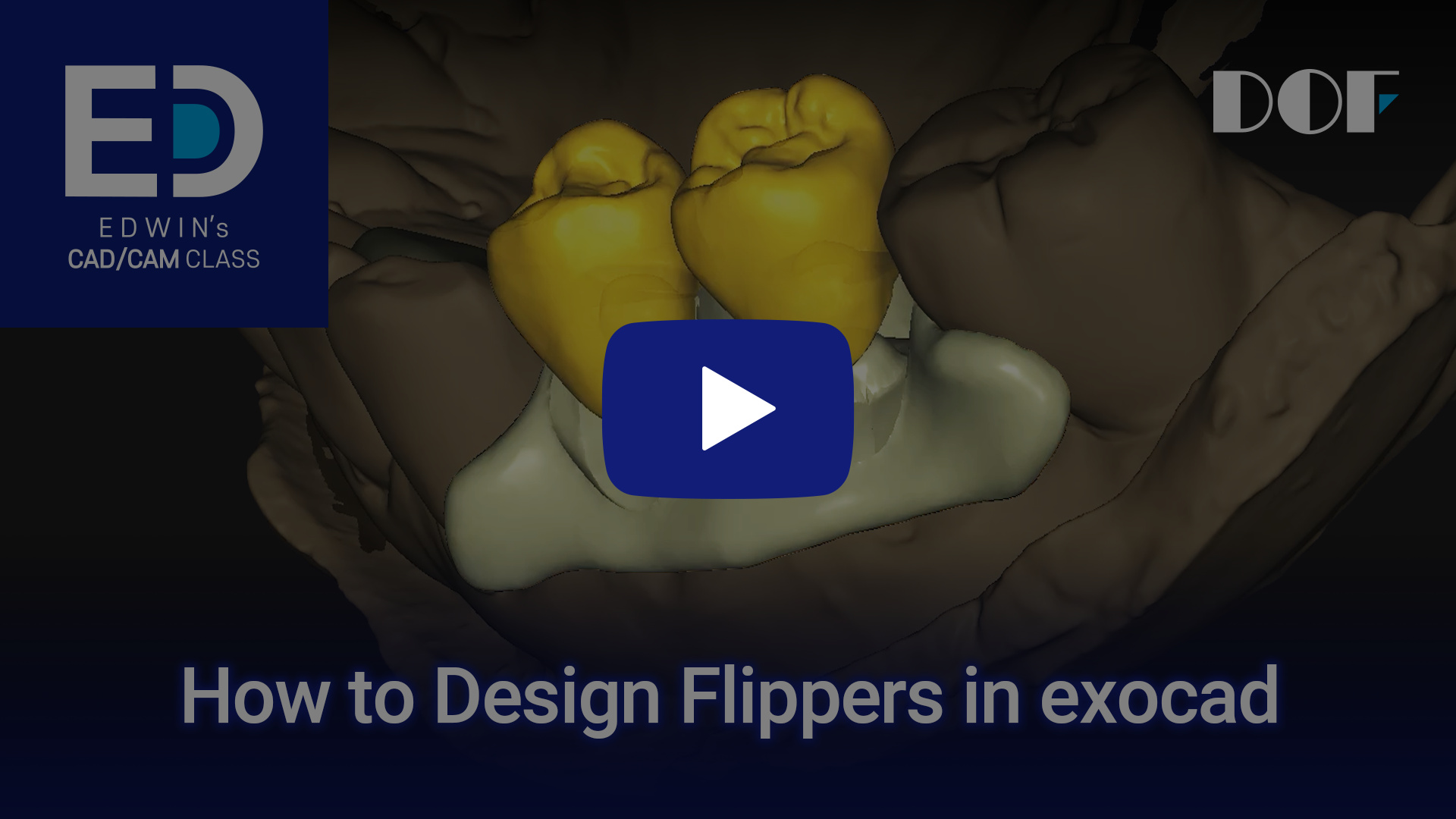 #16 How to Design a Flipper in exocad_4.jpg