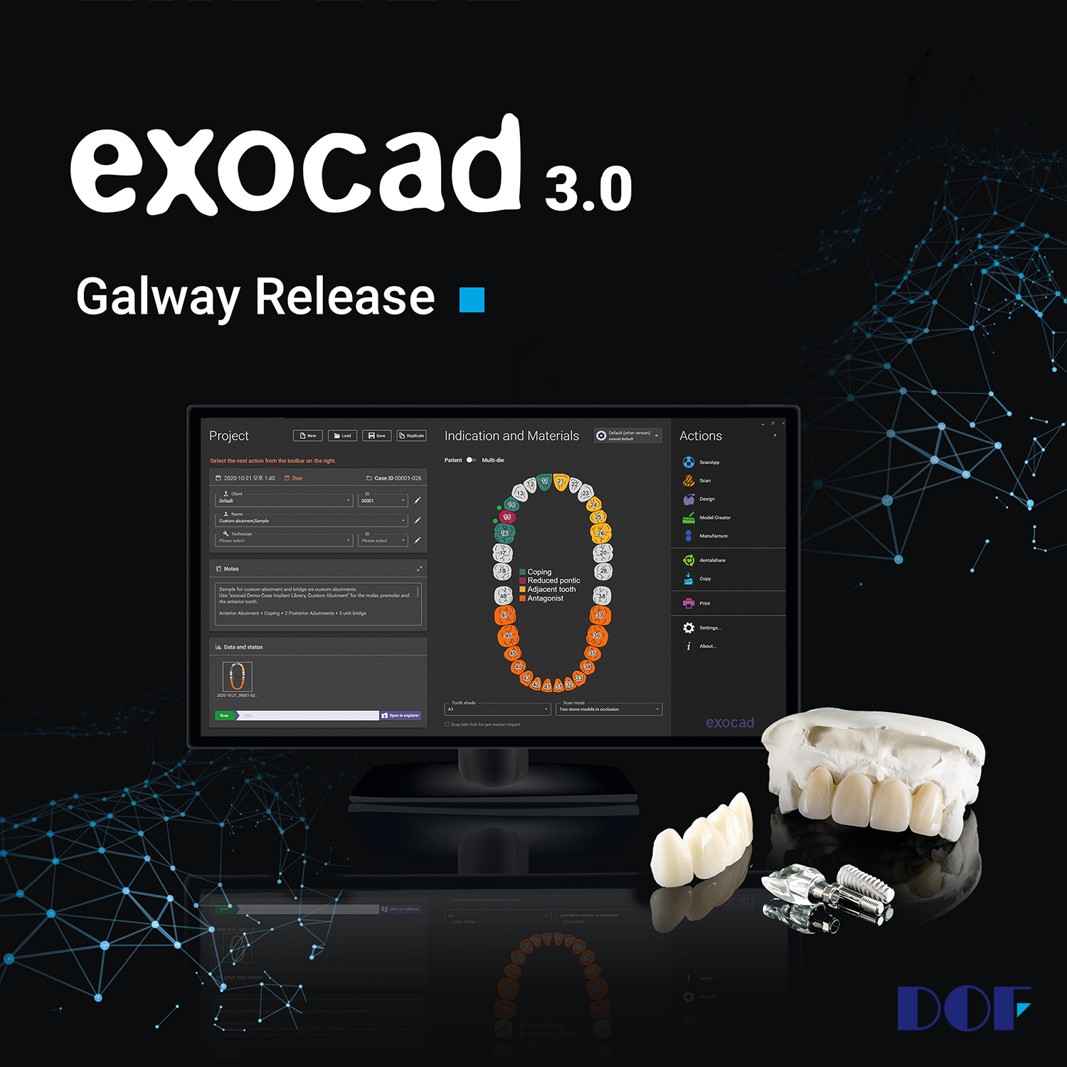 0216_exocad 3.0 Galway Release_1.png