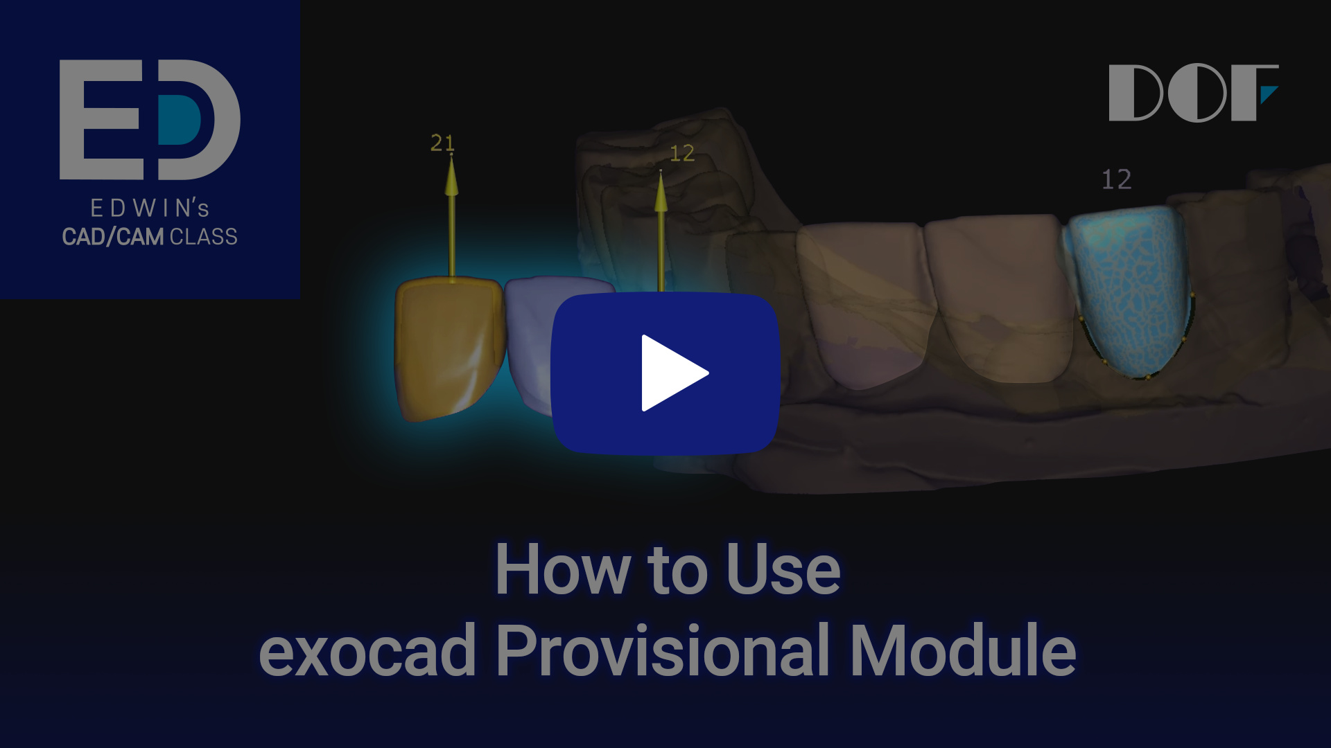 #29 How to Use exocad Provisional Module_4.jpg