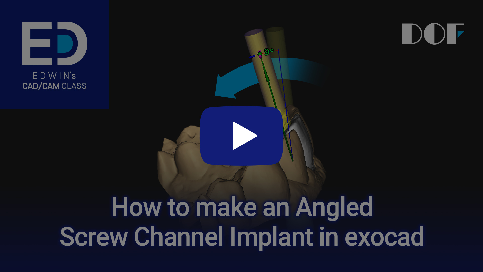 #21 How to Make an Angled Screw Channel Implant in exocad_4.jpg