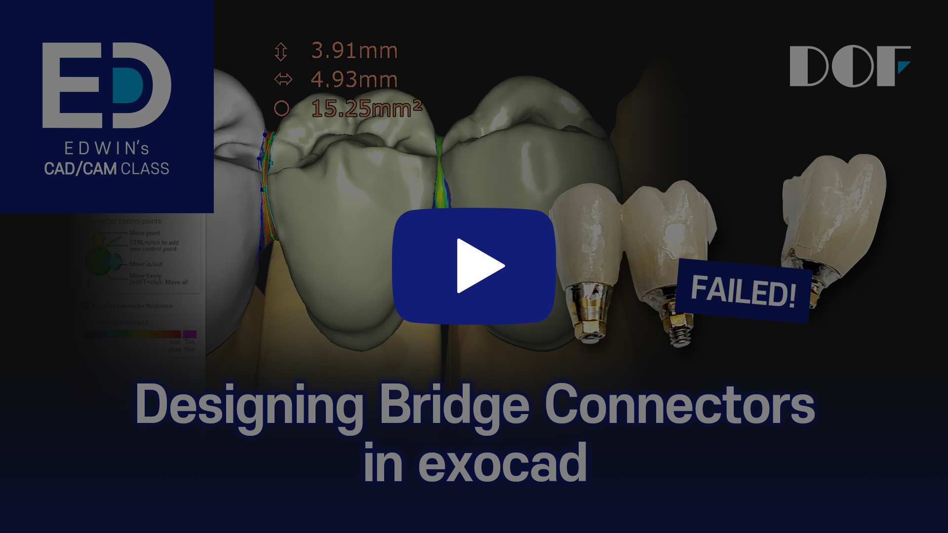 #10 Designing Bridge Connectors in exocad_4.png