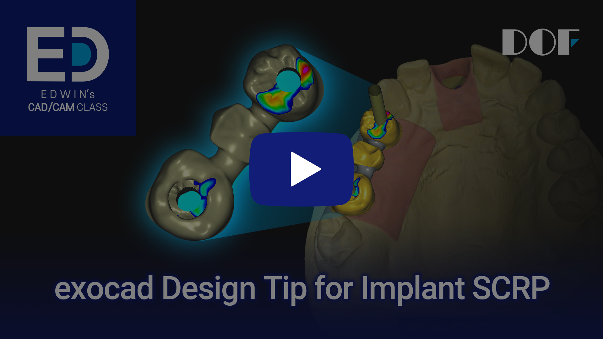 #31 exocad Design Tip for Implant SCRP_4.jpg