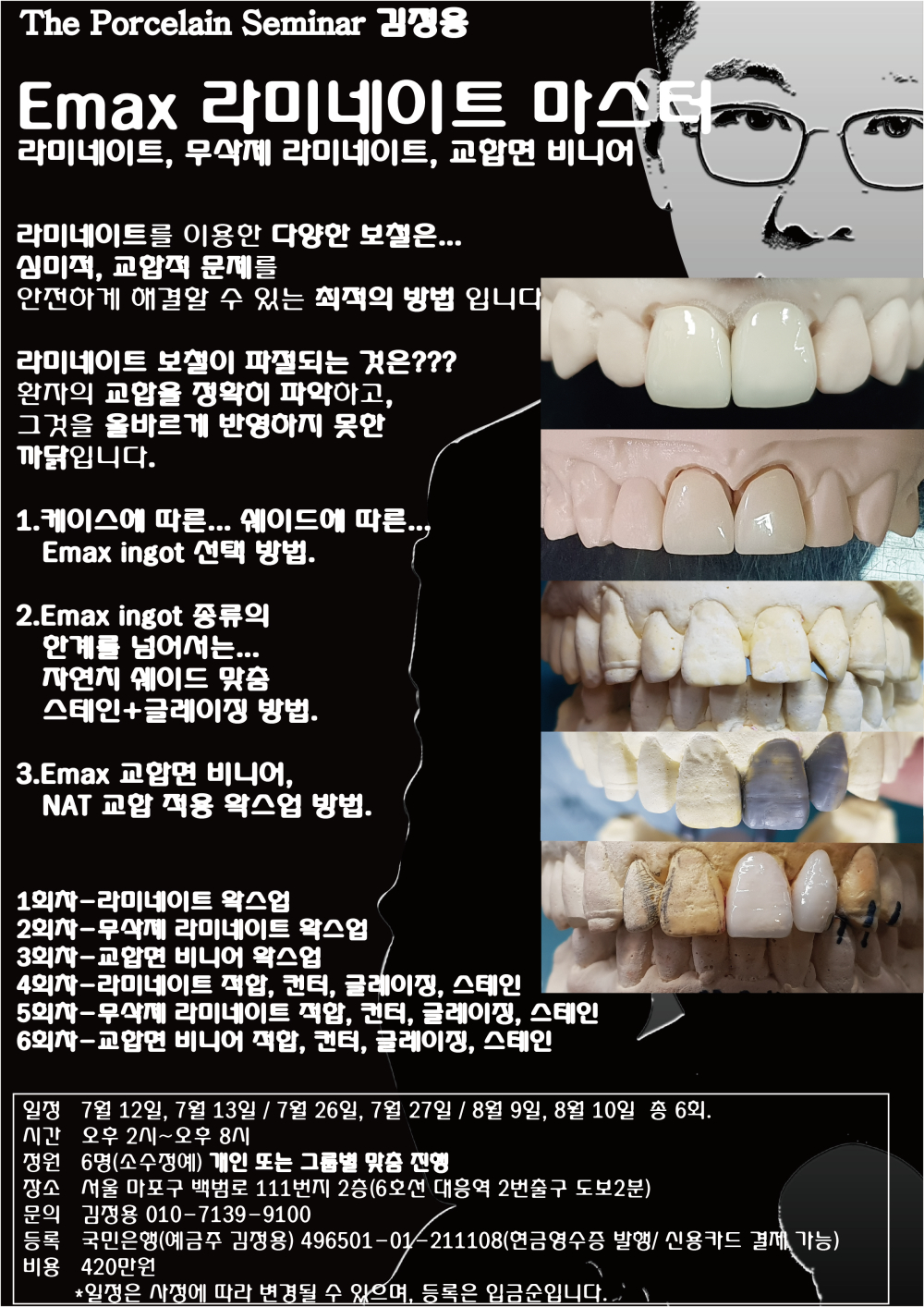 포스터_3.Emax 라미네이트 마스터.jpg
