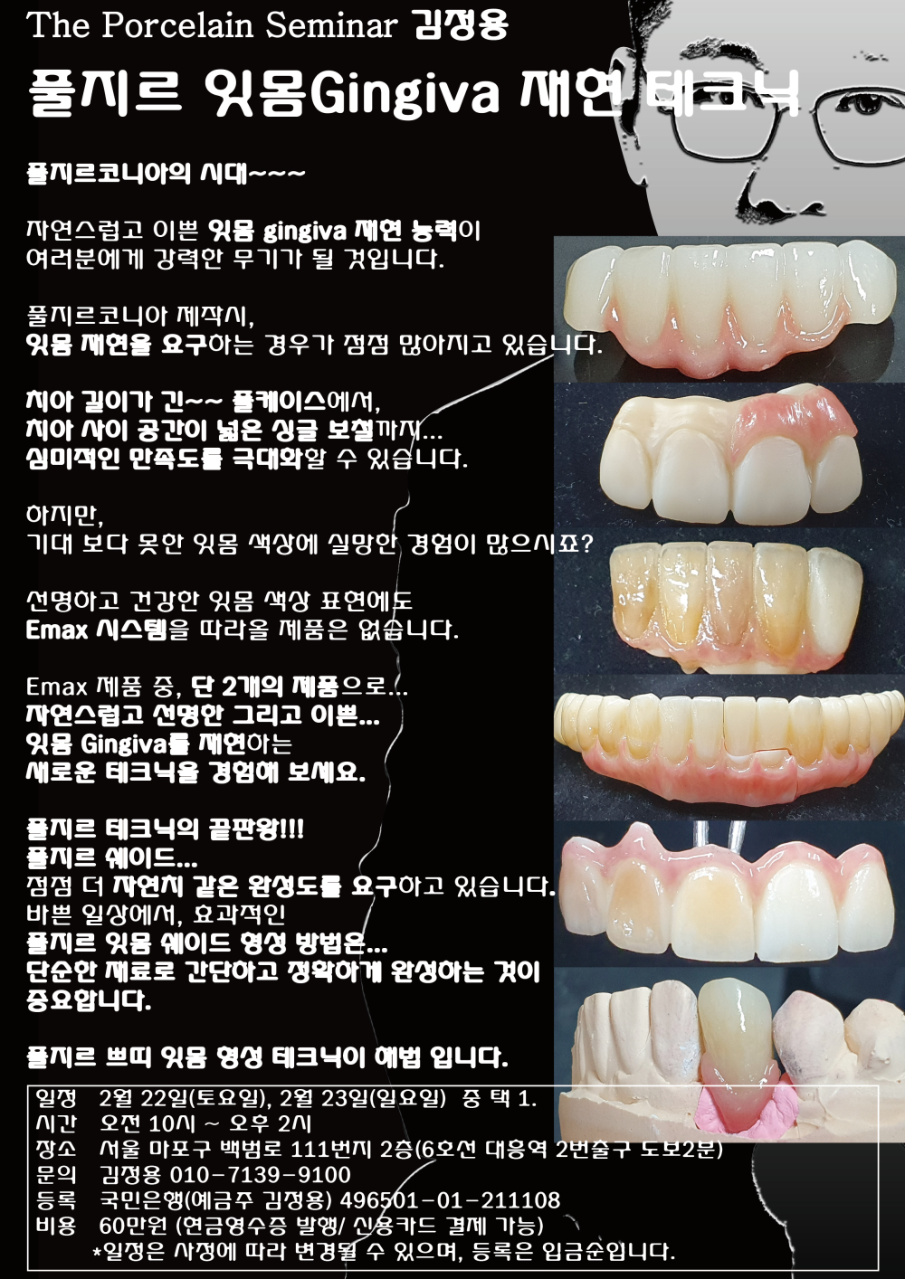 포스터_1.풀지르 잇몸 재현 테크닉.jpg