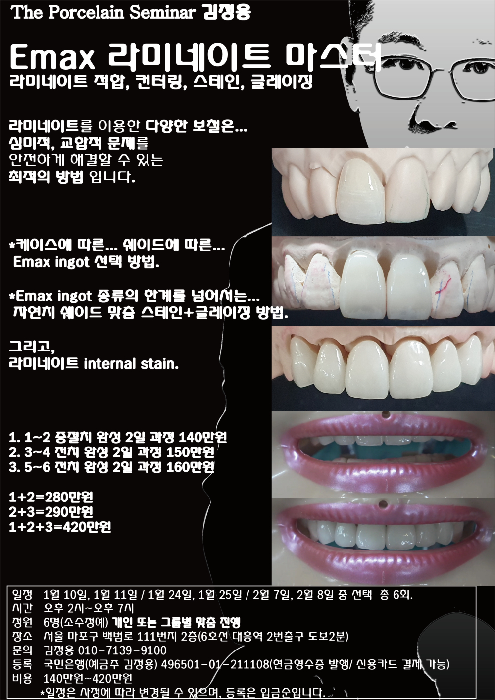 포스터_7.Emax 라미네이트 마스터.jpg