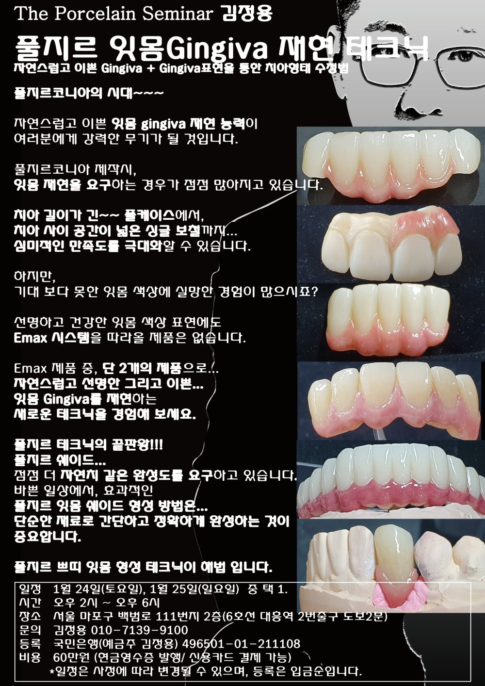 포스터_12.풀지르 잇몸 재현 테크닉.jpg