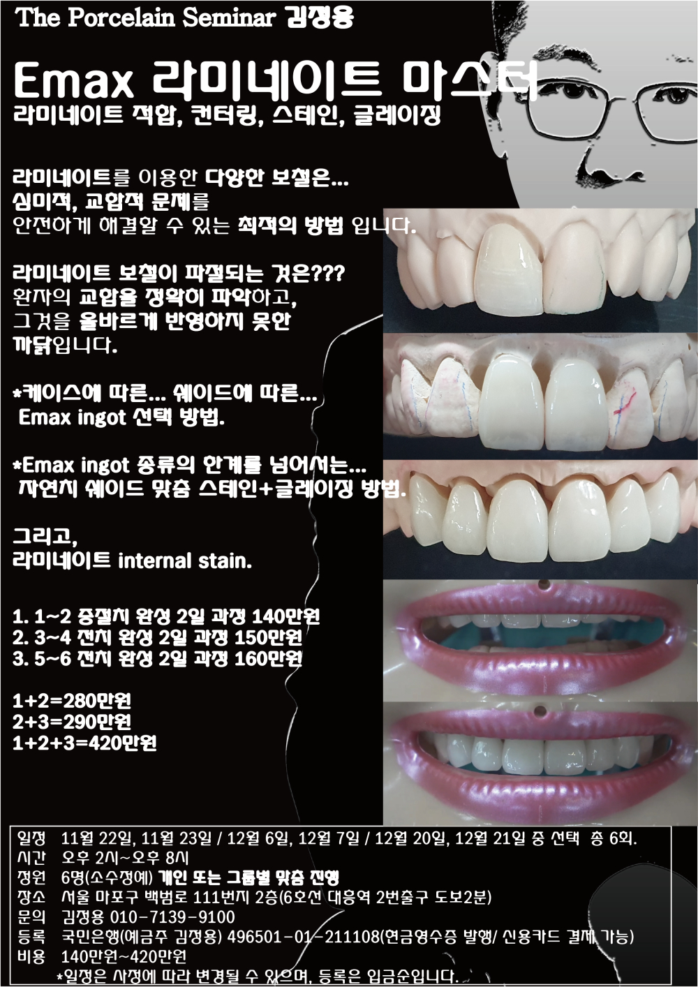 포스터5.Emax 라미네이트 마스터.jpg