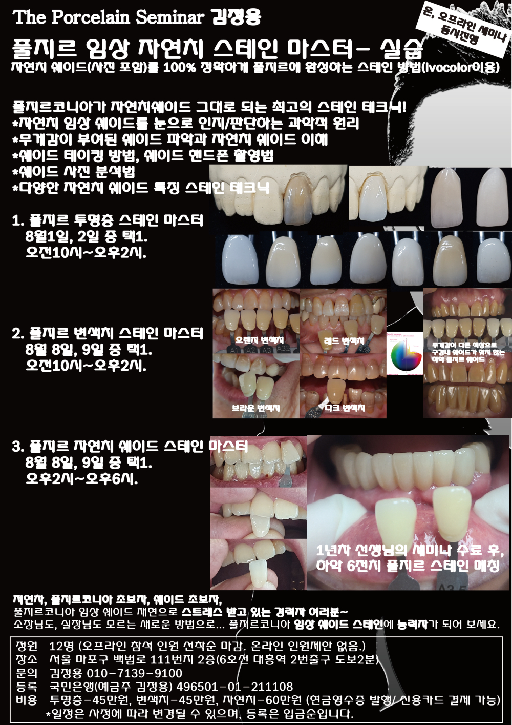 포스터_4풀지르 임상 자연치 스테인 마스터.jpg
