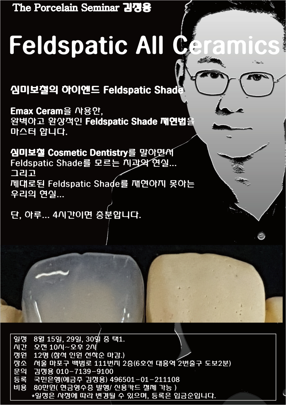 포스터_8Feldspatic all ceramics-01.jpg
