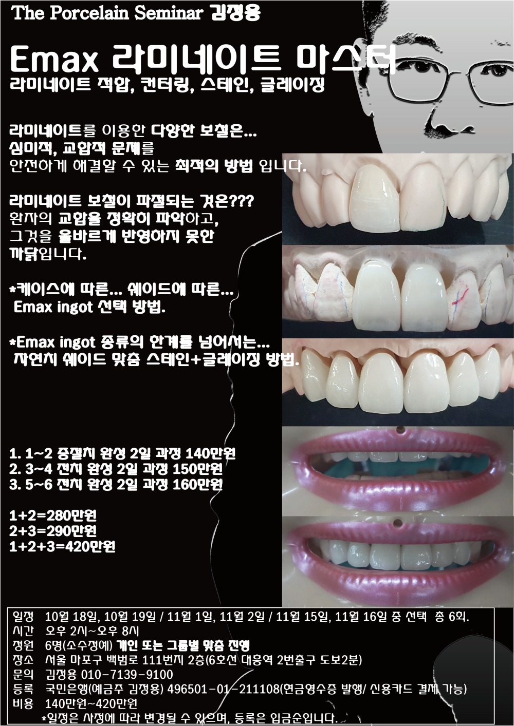 포스터_4.Emax 라미네이트 마스터.jpg