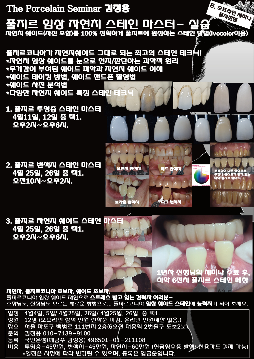 김정용_4.풀지르 임상 자연치 스테인 마스터.jpg