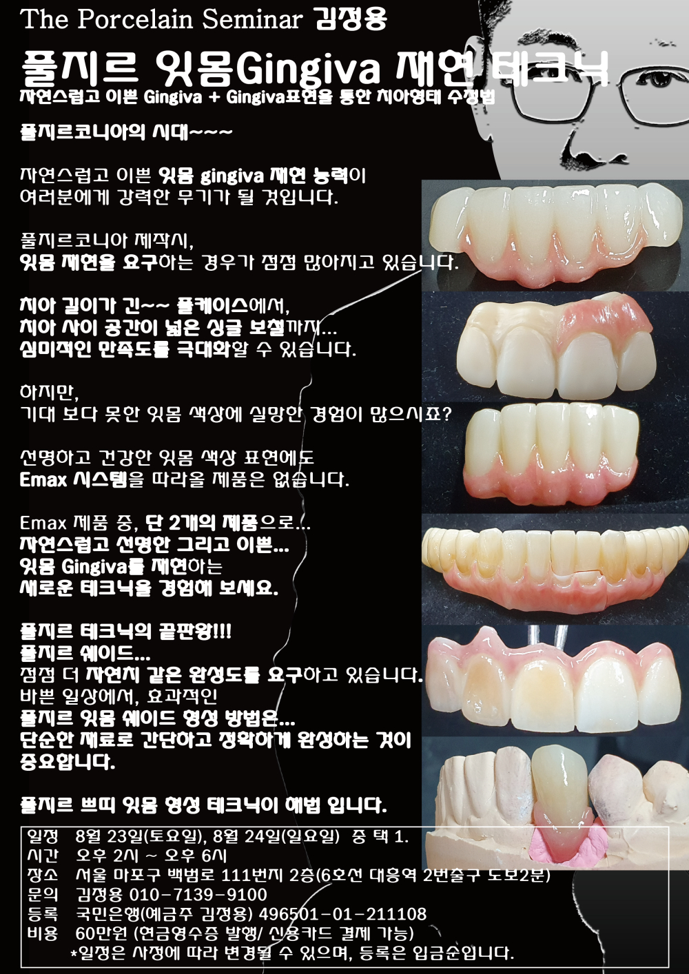 포스터_2.풀지르 잇몸 재현 테크닉.jpg