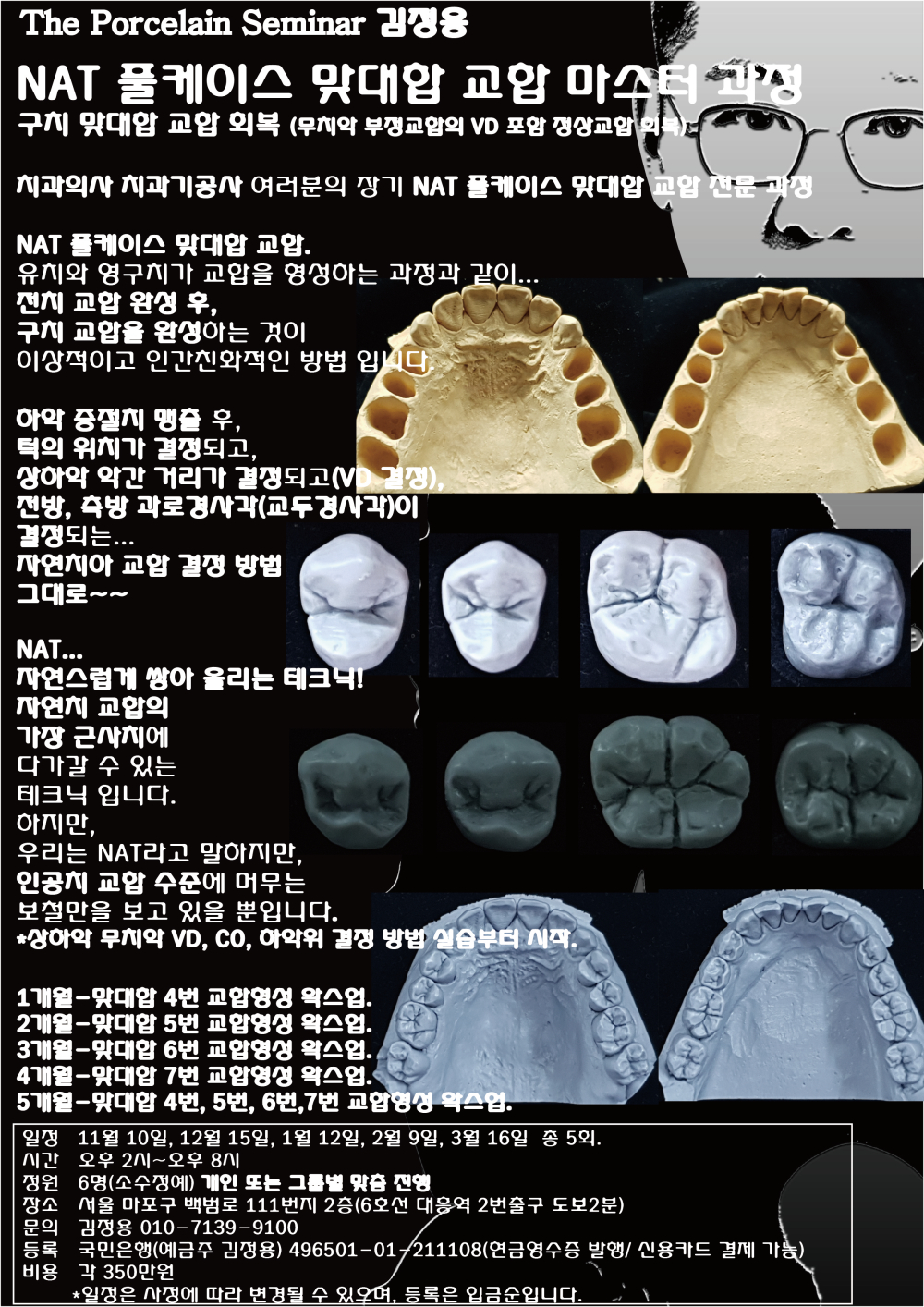 포스터14.NAT 풀케이스 맞대합 구치 교합 마스터.jpg