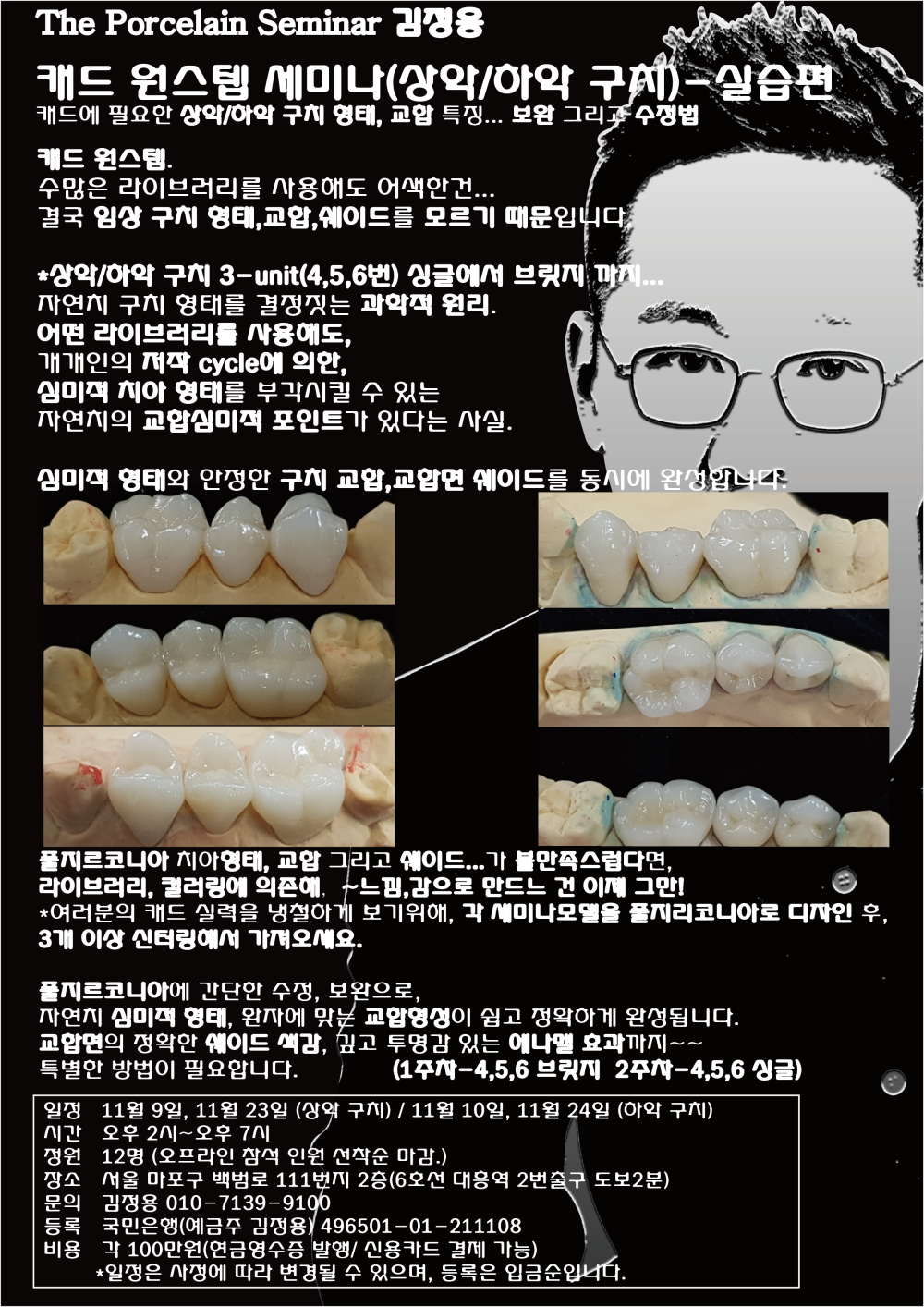 포스터4.임상캐드원스텝세미나 상하악구치.jpg