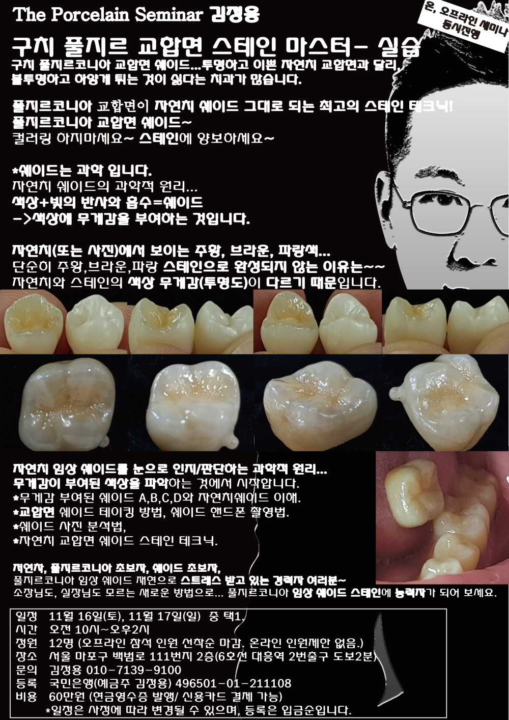 포스터6.구치 풀지르 교합면 스테인 마스터.jpg