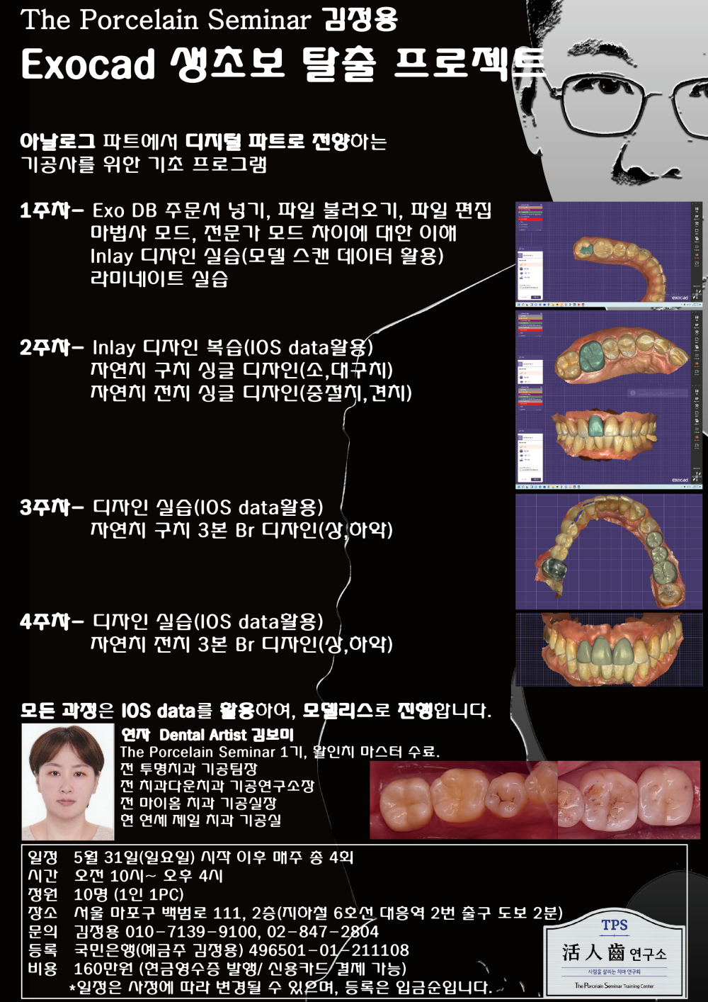 김정용_8.Exocad 생초보 탈출.jpg