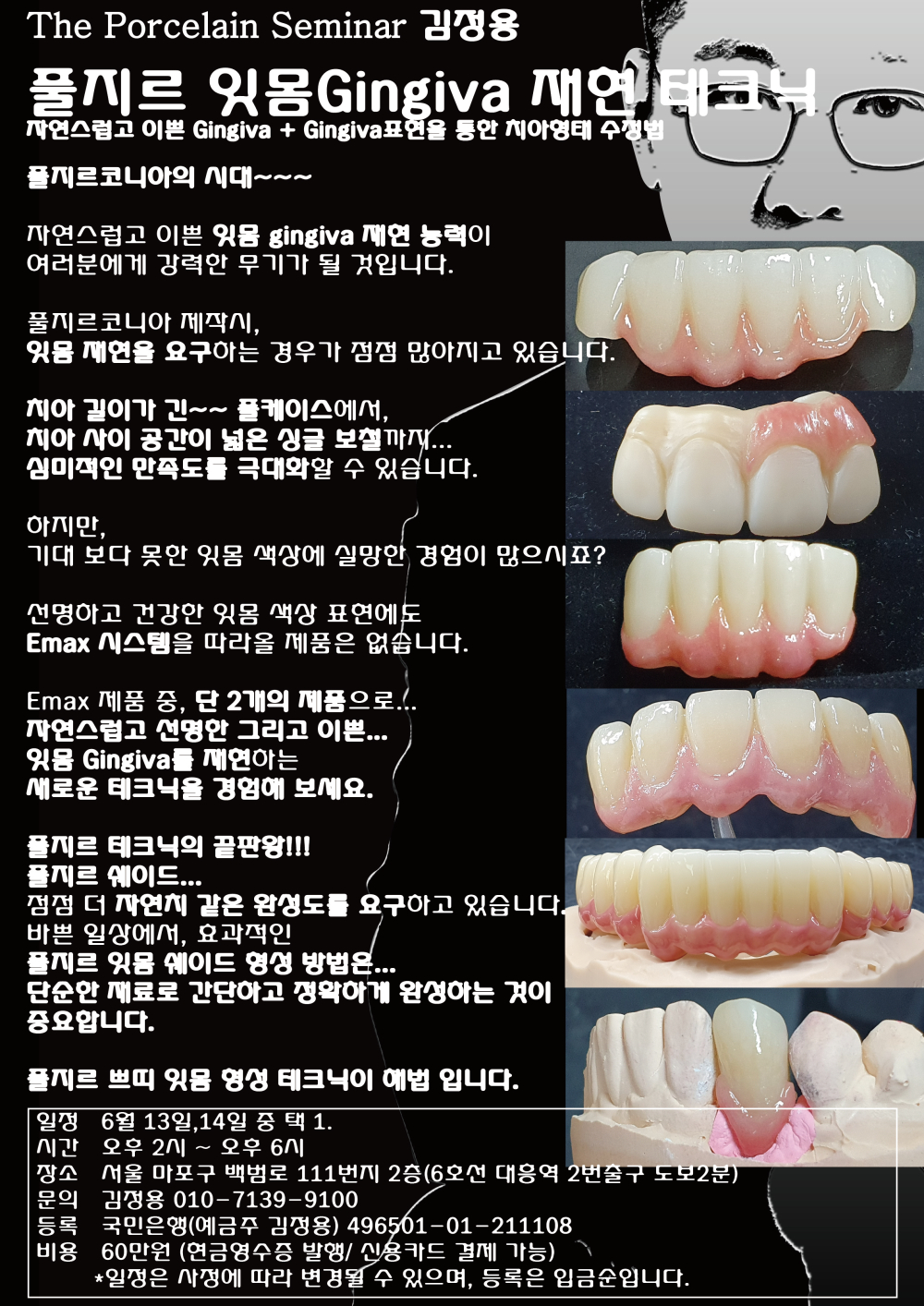 김정용_13.풀지르 잇몸 재현 테크닉.jpg