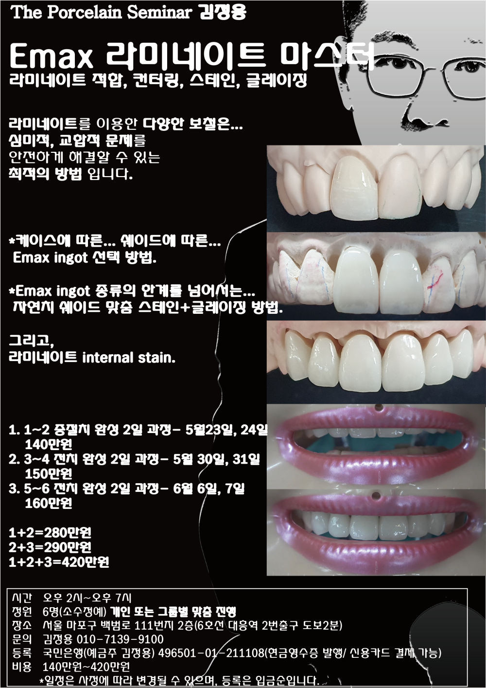 김정용_7.Emax 라미네이트 마스터.jpg