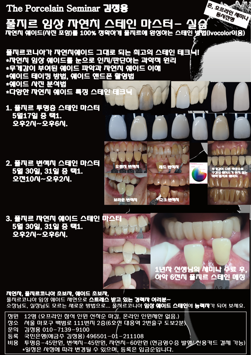 김정용_5.풀지르 임상 자연치 스테인 마스터.jpg