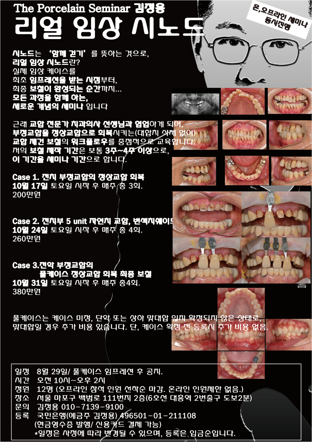 포스터_13리얼 임상 시노드.jpg