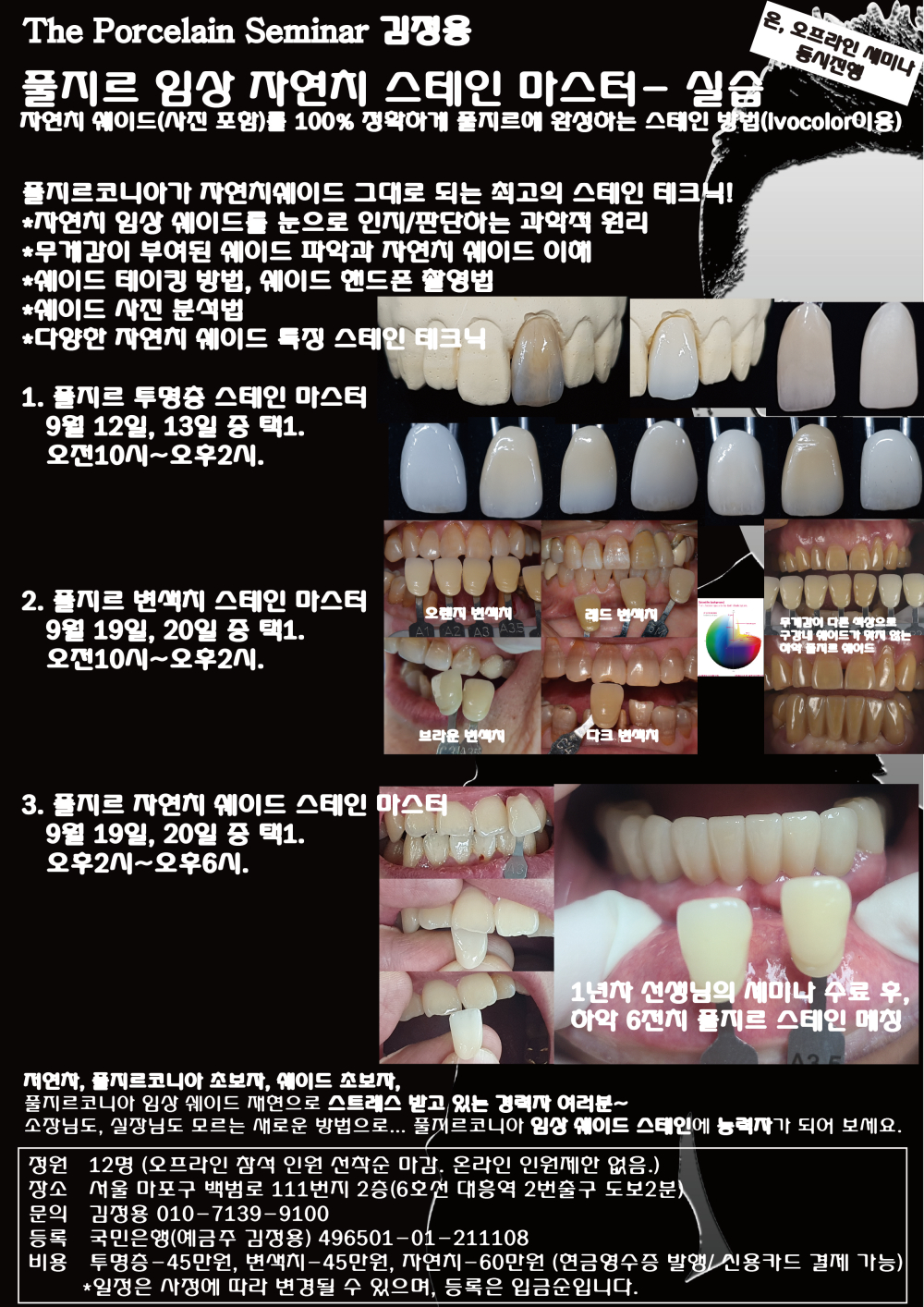 포스터_4풀지르 임상 자연치 스테인 마스터.jpg