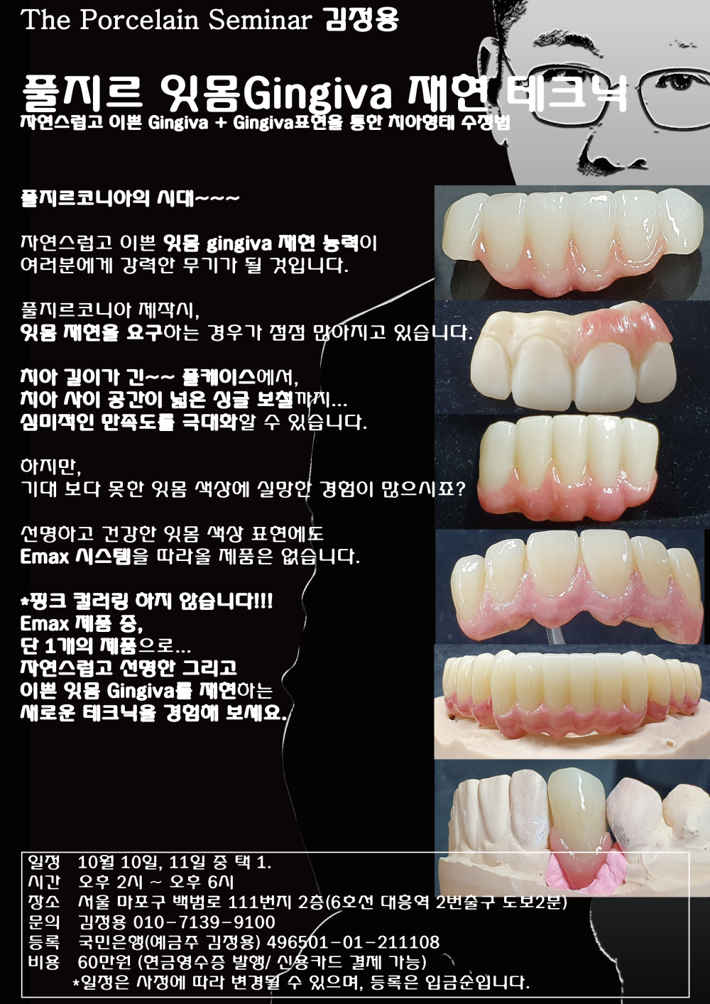 포스터_12풀지르 잇몸 재현 테크닉.jpg