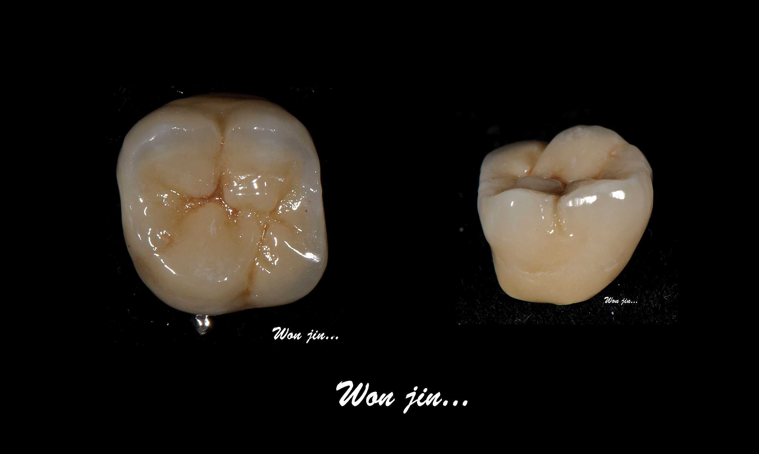 molar1.jpg