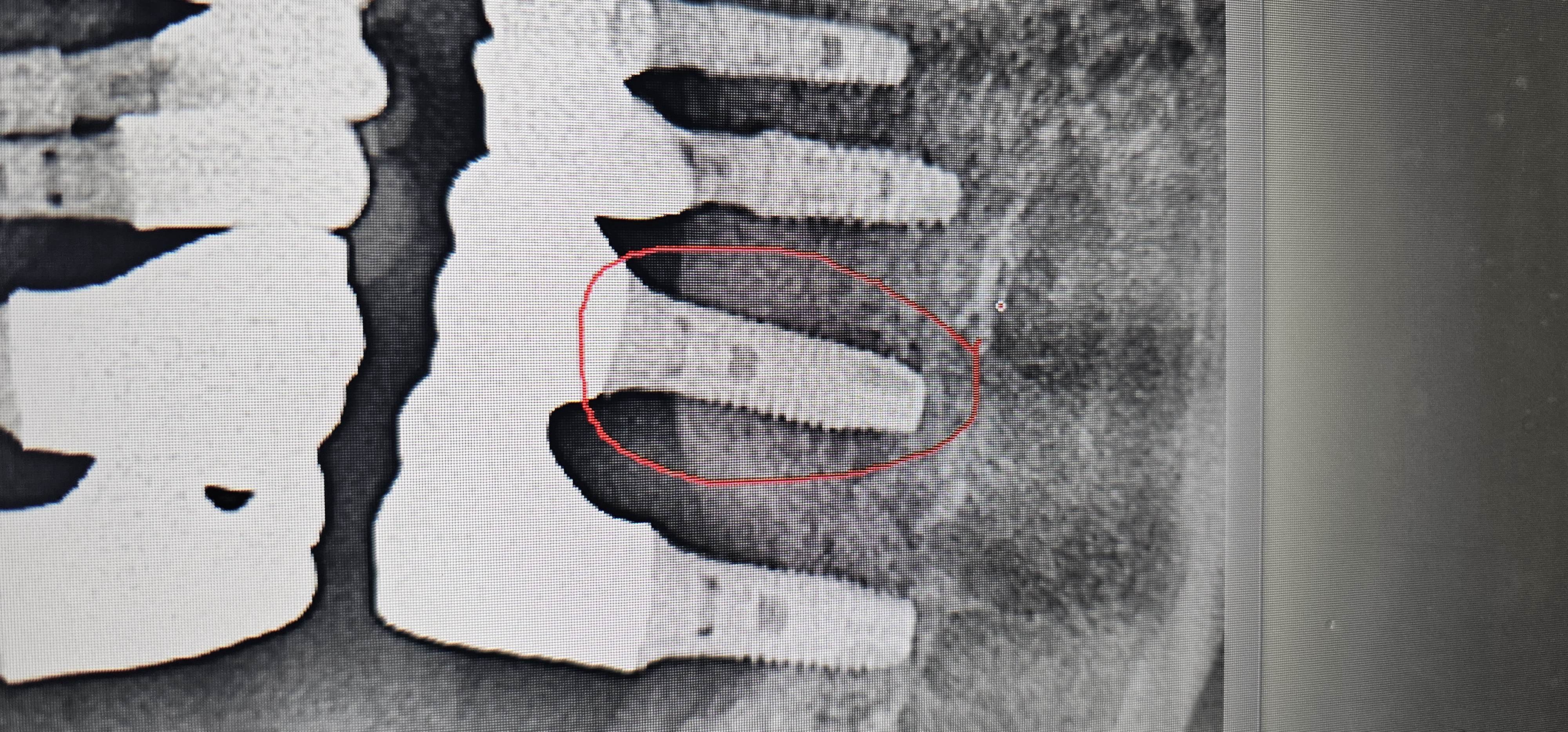 20250411_173216.jpg