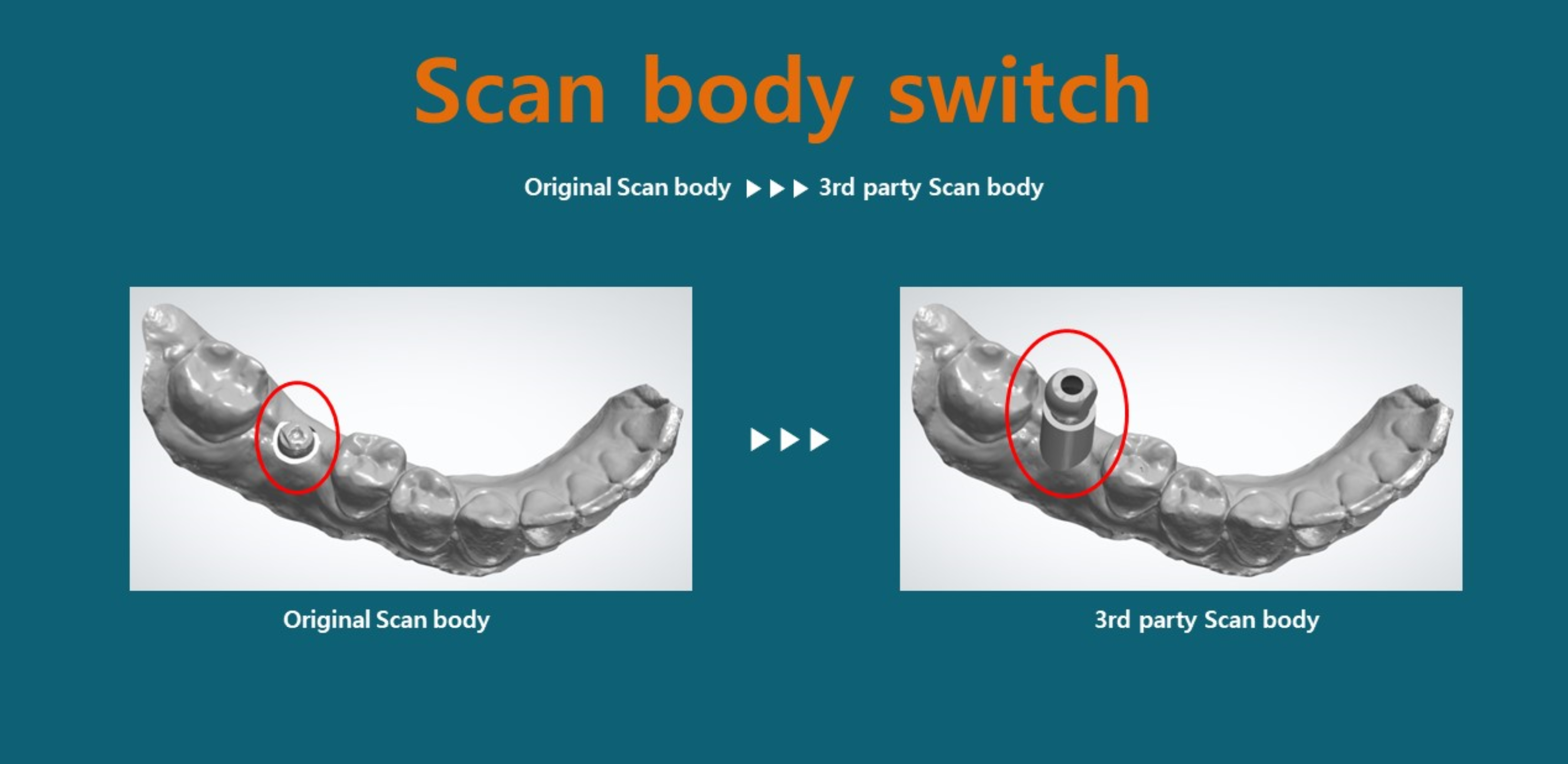 Scan Body Switch.png