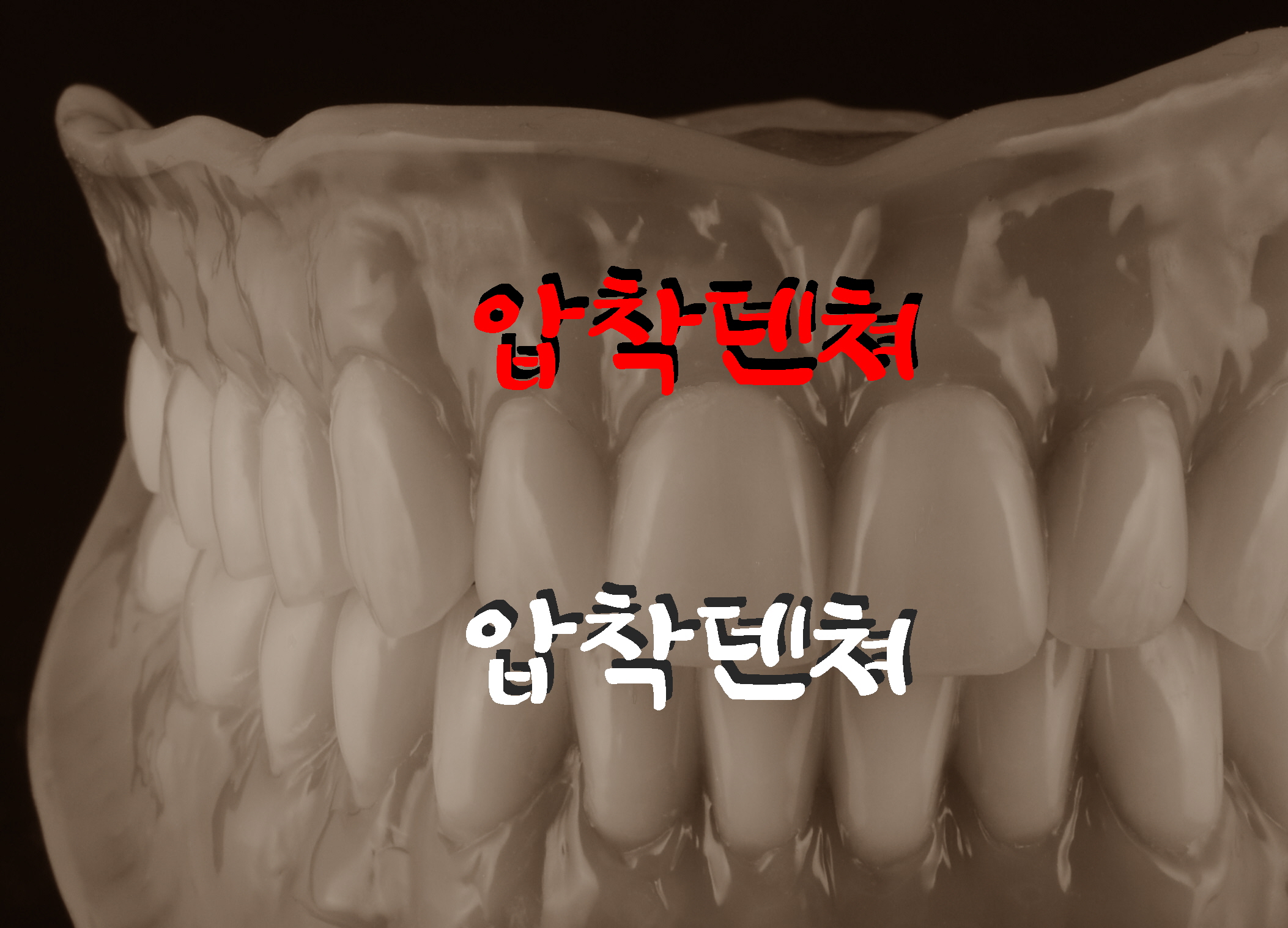 압착덴쳐.jpg